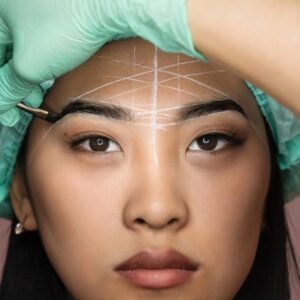 A woman with brow transformation lines on her face, pre-treatment
