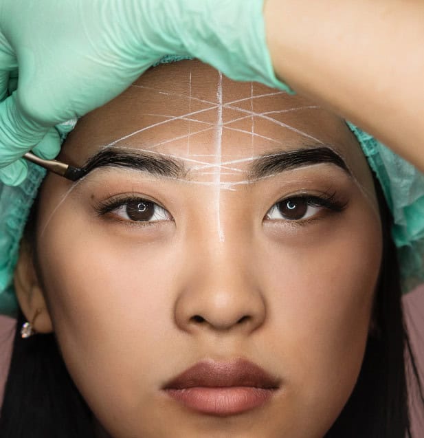 A woman with brow transformation lines on her face, pre-treatment